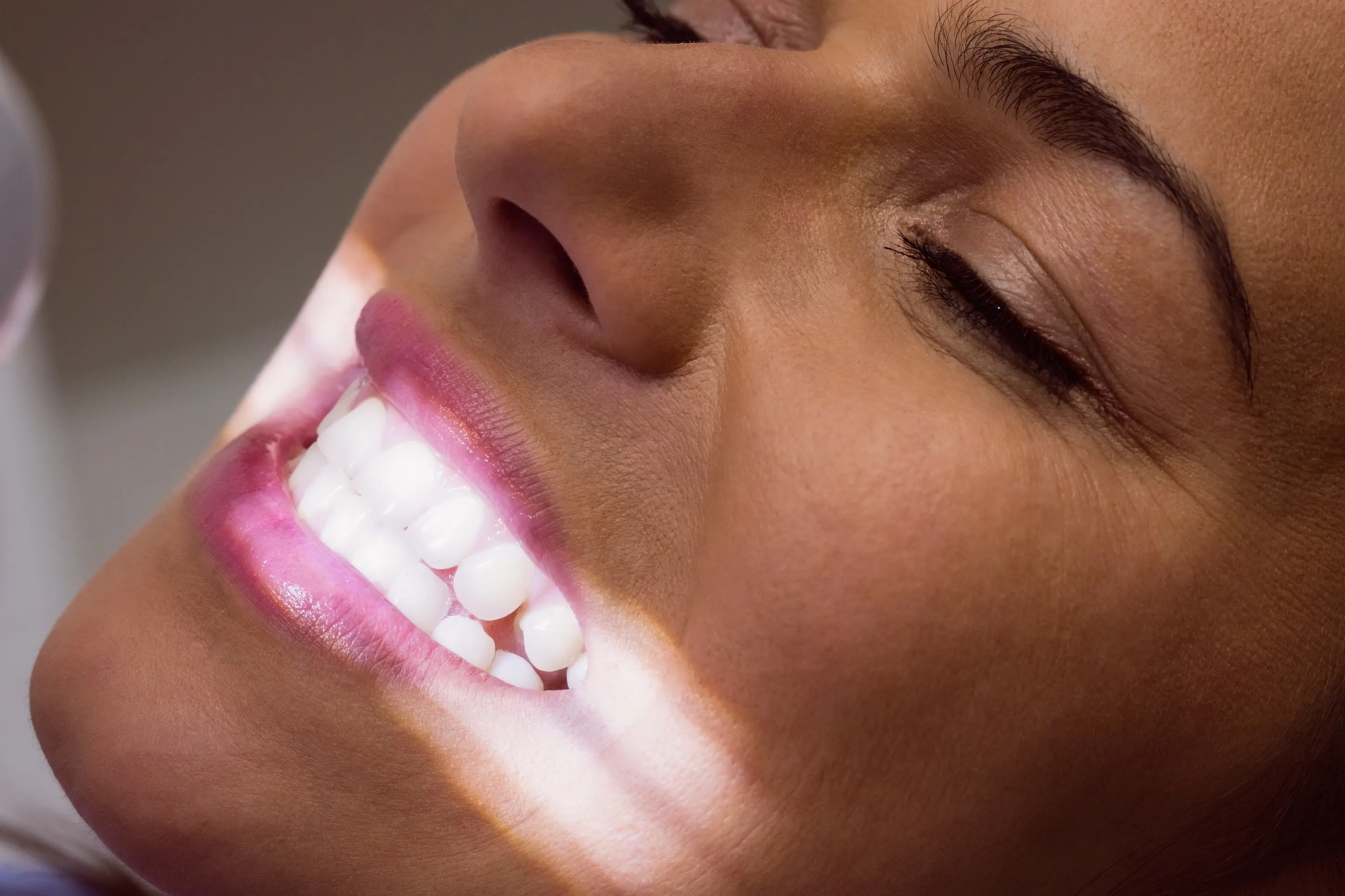 professional teeth whitening treatment in Sugar Land