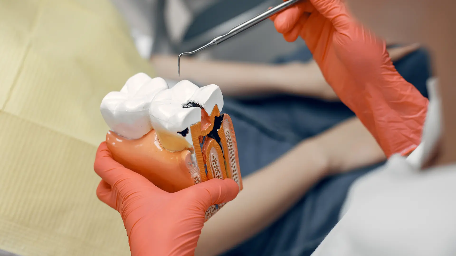 Dentist demonstrating root canal treatment