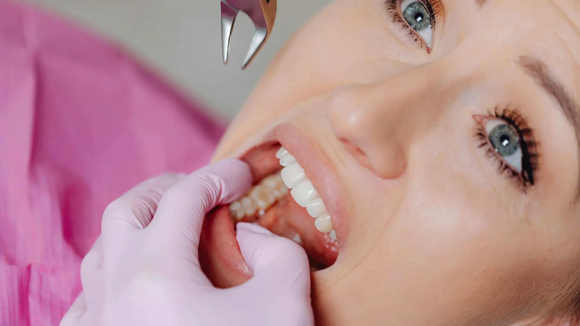 Patient sitting for wisdom teeth removal in Sugar Land